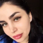 medeo giallo yeşil renkli kontakt lens