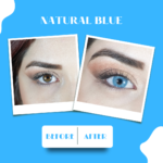 natural blue öncesi sonrası