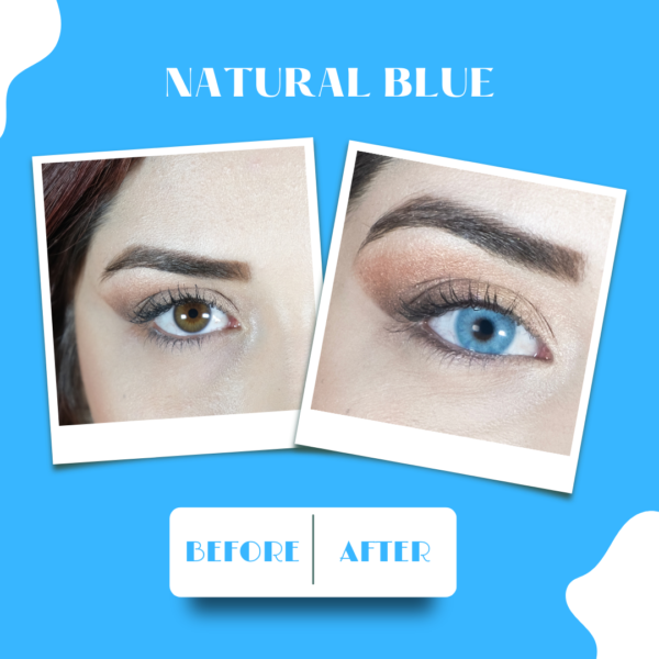 natural blue öncesi sonrası