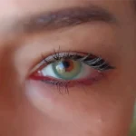hypnose-star-green-2-yillik-lens