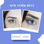 new york blue öncesi sonrası